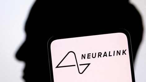 Neuralink Takes a Groundbreaking Step: The First Human Trial of Brain-Computer Interface Implant