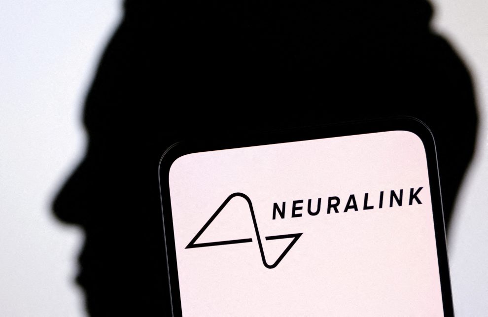 Neuralink Takes a Groundbreaking Step: The First Human Trial of Brain-Computer Interface Implant