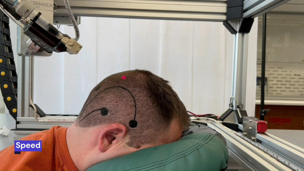 Revolutionary E-Tattoos Printing Brain Monitoring Electronics Directly on the Scalp