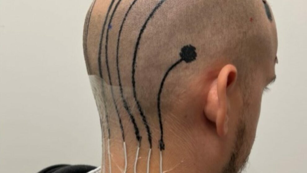 Revolutionary E-Tattoos Printing Brain Monitoring Electronics Directly on the Scalp